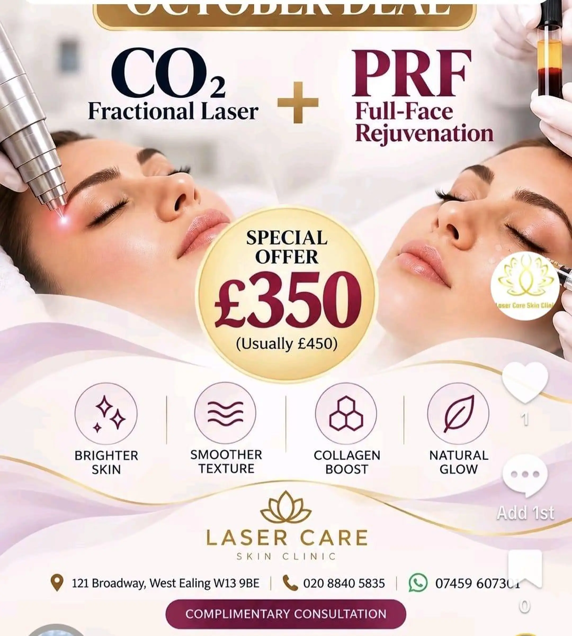 CO2 fractional laser and PRF full-face rejuvenation special offer for £350